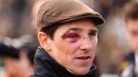 'No way he should be riding' say punters after seeing jockey's black eye