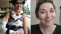 Docs reattach ‘decapitated’ woman’s HEAD after skull detached from spine