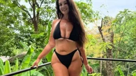 I'm a size 20 with Shaughna Phillips' leg condition - how to tell if you have it