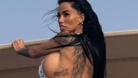 Katie Price shows off the result of 'botched' Brazilian bum lift