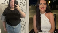 I lost 5 STONE in 12 weeks after £11k surgery but it almost killed me