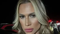 Instagram star dies after ‘fox eyes’ surgery left him with face infection