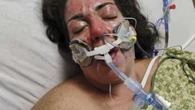 My skin melted as I tried to save my sons from house fire caused by the laundry
