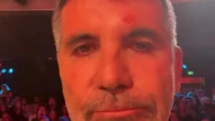 Real reason Simon Cowell pulled out of BGT auditions revealed