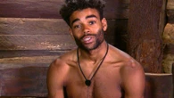 I’m A Celebrity star in hospital for surgery to remove lump from face