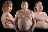 We have an incurable cancer half of Brits aren't aware of - know the 11 symptoms