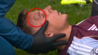 Lucas Digne suffers gruesome head injury after colliding with Villa team-mate
