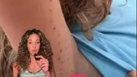Boy, 6, left injured after octopus clings on his arm in brazen attack