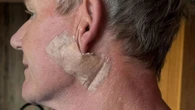 Gordon Ramsay reveals surgery to remove cancer and issues warning to fans