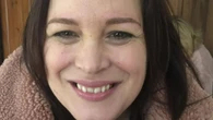 I regret not seeing GP for embarrassing symptoms - now I have incurable cancer