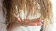 How the hot & humid summer weather causes frizzy hair, breakage & bald spots