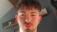 Emmerdale star unrecognisable 18 months after quitting soap