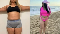 I got a mummy makeover in Mexico to save £19k banishing my saggy tum