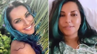 I saw chiropractor for back pain - I blacked and was rushed to ICU with deadly tear