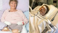 Mum’s UTI led to life-threatening condition & four limbs being amputated