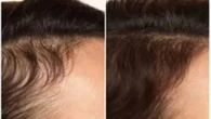 The £7 Boots serum shoppers are raving about for quick hair growth