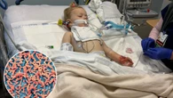 Tot fighting for life after swim left her infected with 3 strains of deadly bug