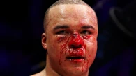 Wardley lived off ice cream and noodles after brutal Frazer Clarke fight
