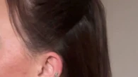 I was suffering with hair loss… a special 'syrup' made it grow back in 2 months