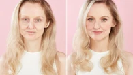 Fat jabs gave me Ozempic face - but I've found solution WITHOUT fillers