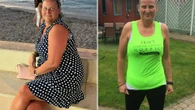 I'm spending £9k to fix my fat jab side effects… I can tuck my belly into my pants