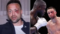 Taylor shows off brutal face injuries and explains why he stormed out of ring