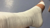 Boyband star shares hospital snap and reveals he will be on crutches for months