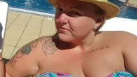 I had to talc my belly folds & didn’t fit on fair rides so had £5k mum makeover