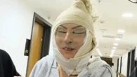 Mum’s facelift goes viral & sparks concern with people asking 'is she alive?'