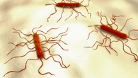 Major supermarket urgently recalls chicken over 'killer' bacteria