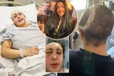 I lost half my skull after drinking rosé with a pal resulted in a horror fall