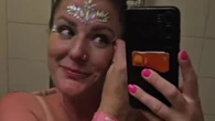 Mum who went to festival shows side effect of wearing face gems in the sun