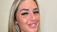 I had a glow-down after rocking fake hair - people say I look 'breathtaking'
