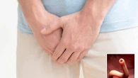 Man discovers a WORM wriggling around inside his penis after trip to the beach