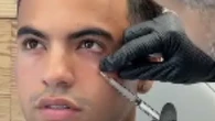 Love Island’s Harrison, 22, reveals pre-villa glow with celebrity doctor