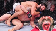 Chimaev made me 'get rid of crap teeth' says Whittaker after horror injury