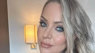 Rita Simons reveals she's having fillers dissolved after 'regretting' them