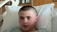 Boy, 12, 'melted away' skin in viral TikTok experiment before brother saved him