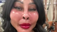 Mum shows off ‘glass skin’ but mean trolls say she ‘better have sued’ injector