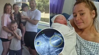 I had to get sterilised after falling pregnant 3 times while on contraception