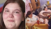 My mum is one of Britain’s fattest women at 31st & I’ve cared for her since 11