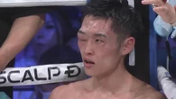 Boxer pulled out of title fight after suffering grotesquely swollen eye