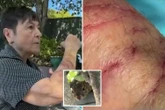 Squirrel attacks send two to the ER with warning it 'appears from nowhere'