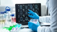 Two NHS drugs slow and could REVERSE devastating Alzheimer's, study finds