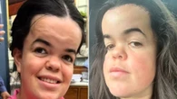 The Traitors star Meryl Williams reveals results of secret forehead surgery