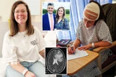 I suffered odd migraine - then docs found brain tumour that had grown for 20 YEARS