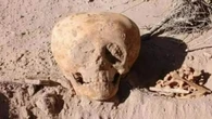 Disturbing alien-like deformed SKULL belonging to 'archaic' human stuns experts