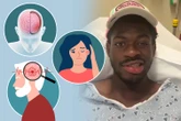 The 6 reasons you could suffer facial paralysis after Lil Nas X in hospital