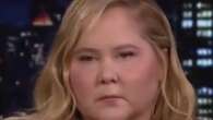 Amy Schumer reveals trolling over 'moon face' led to Cushing Syndrome diagnosis