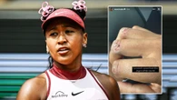 Naomi Osaka mulls tennis break as she reveals nasty hand injury